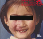 血管瘤病理图片图1-图20(图3)