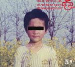 血管瘤病理图片图1-图20(图9)