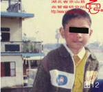 血管瘤病理图片图1-图20(图12)