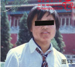 血管瘤病理图片图1-图20(图13)