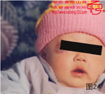 血管瘤病理图片图21-图40(图3)