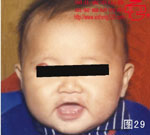 血管瘤病理图片图21-图40(图8)