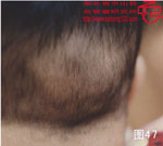 血管瘤病理图片图41-图60(图7)