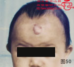 血管瘤病理图片图41-图60(图9)