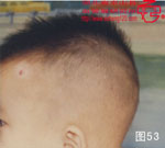 血管瘤病理图片图41-图60(图13)