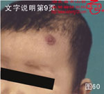 血管瘤病理图片图241-图260(图20)
