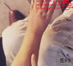 血管瘤病理图片图61-图80(图4)