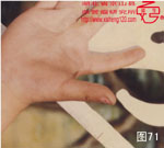 血管瘤病理图片图61-图80(图10)