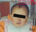 血管瘤病理图片图81-图100(图3)