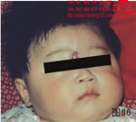 血管瘤病理图片图81-图100(图5)