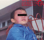 血管瘤病理图片图81-图100(图11)