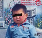 血管瘤病理图片图81-图100(图16)