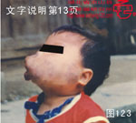 血管瘤病理图片图121-图140(图3)