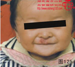 血管瘤病理图片图121-图140(图5)