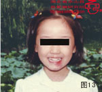 血管瘤病理图片图121-图140(图11)