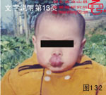 血管瘤病理图片图121-图140(图12)
