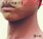 血管瘤病理图片图141-图160(图5)