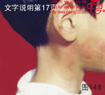 血管瘤病理图片图141-图160(图8)