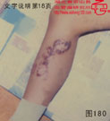 血管瘤病理图片图161-图180(图19)