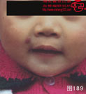 血管瘤病理图片图181-图200(图8)