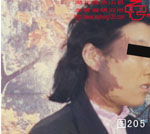 血管瘤病理图片图201-图220(图4)