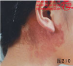血管瘤病理图片图201-图220(图9)