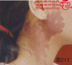 血管瘤病理图片图201-图220(图11)