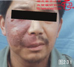 血管瘤病理图片图221-图240(图10)