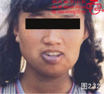 血管瘤病理图片图221-图240(图11)