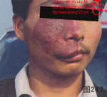 血管瘤病理图片图241-图260(图2)