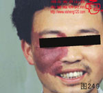 血管瘤病理图片图241-图260(图9)