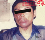 血管瘤病理图片图241-图260(图10)