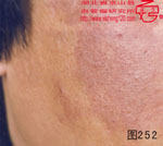 血管瘤病理图片图241-图260(图12)