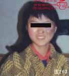 血管瘤病理图片图261-图280(图2)