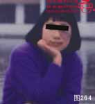 血管瘤病理图片图261-图280(图3)