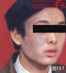 血管瘤病理图片图261-图280(图6)