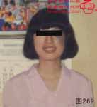 血管瘤病理图片图261-图280(图8)