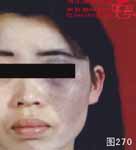 血管瘤病理图片图261-图280(图9)