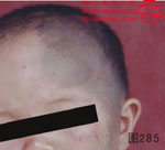 血管瘤病理图片图281-图300(图4)