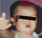 血管瘤病理图片图281-图300(图5)
