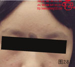 血管瘤病理图片图281-图300(图7)