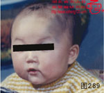 血管瘤病理图片图281-图300(图8)
