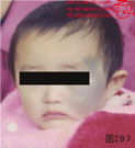 血管瘤病理图片图281-图300(图16)
