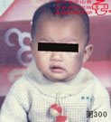 血管瘤病理图片图281-图300(图19)