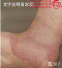 血管瘤病理图片图301-图320(图7)