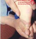 血管瘤病理图片图301-图320(图9)