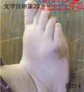 血管瘤病理图片图301-图320(图14)