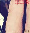 血管瘤病理图片图301-图320(图16)