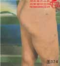 血管瘤病理图片图321-图340(图3)