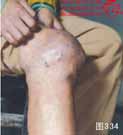 血管瘤病理图片图321-图340(图13)